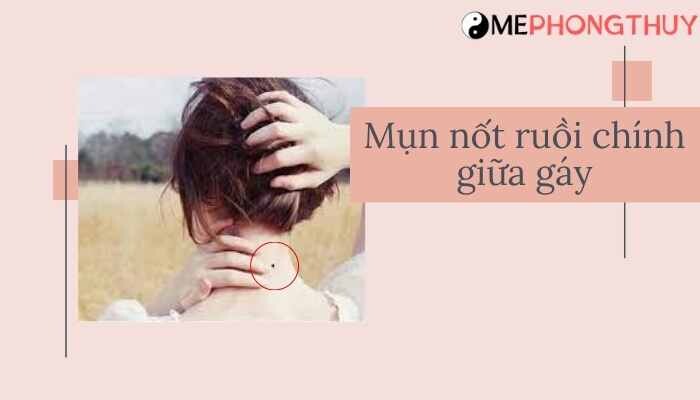 mọc nốt ruồi chính giữa gáy