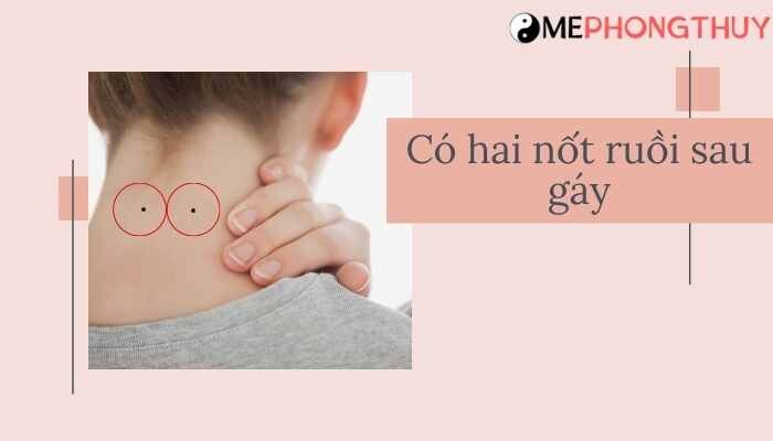 có hai nốt ruồi sau gáy