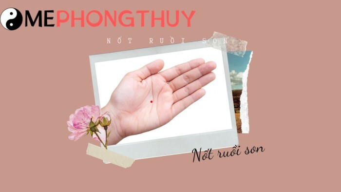 Nốt ruồi son là gì