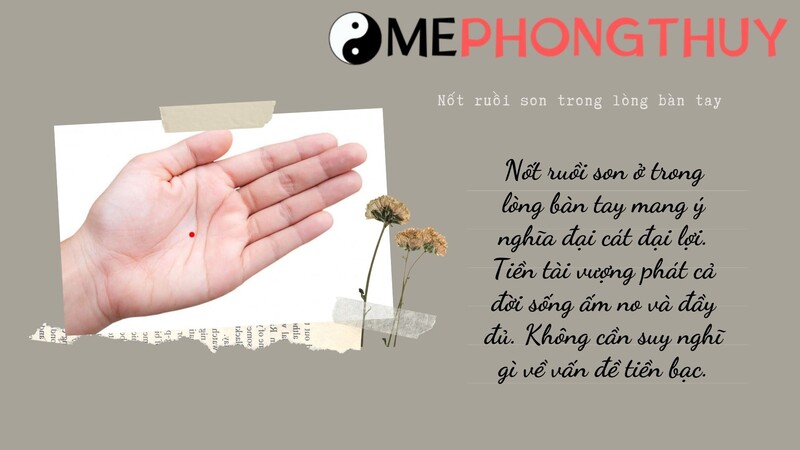 Nốt ruồi son trong lòng bàn tay