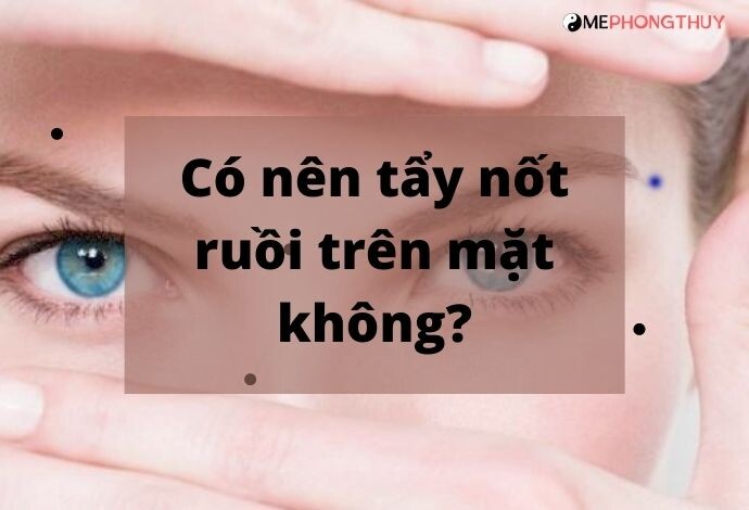 Có nên tẩy nốt ruồi trên mặt không?