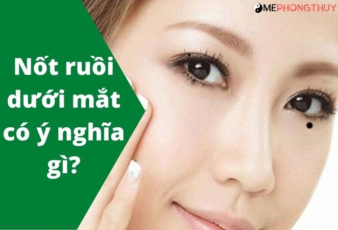 Nốt ruồi dưới mắt có ý nghĩa gì?