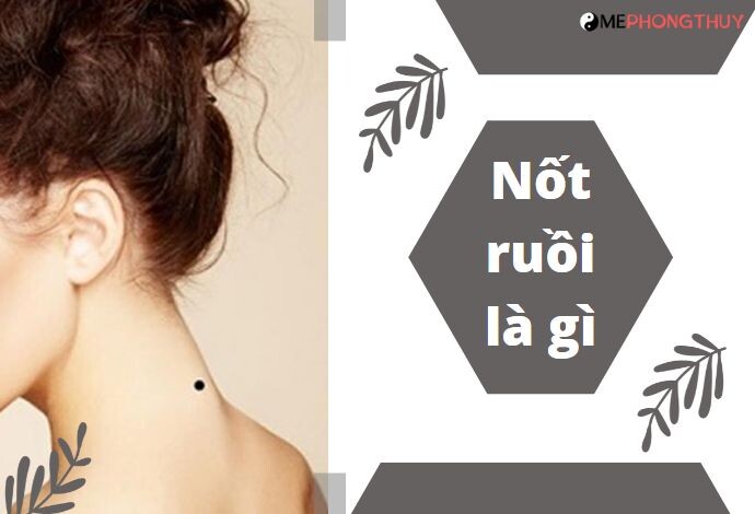 Nốt ruồi là gì?