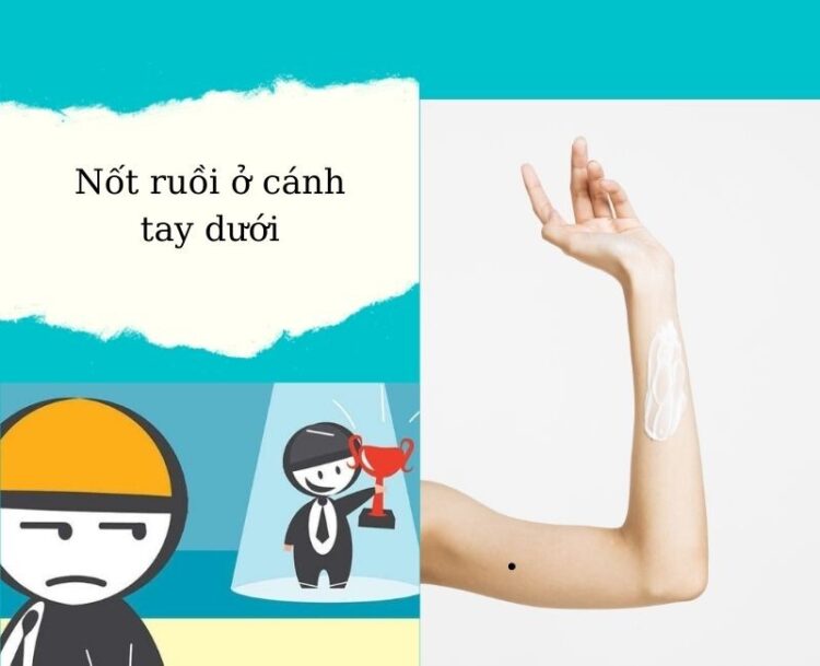 Nốt ruồi ở cánh tay dưới