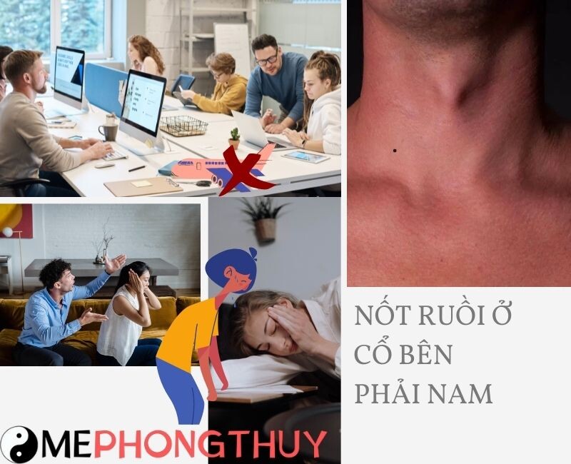 Nốt ruồi ở cổ bên phải nam