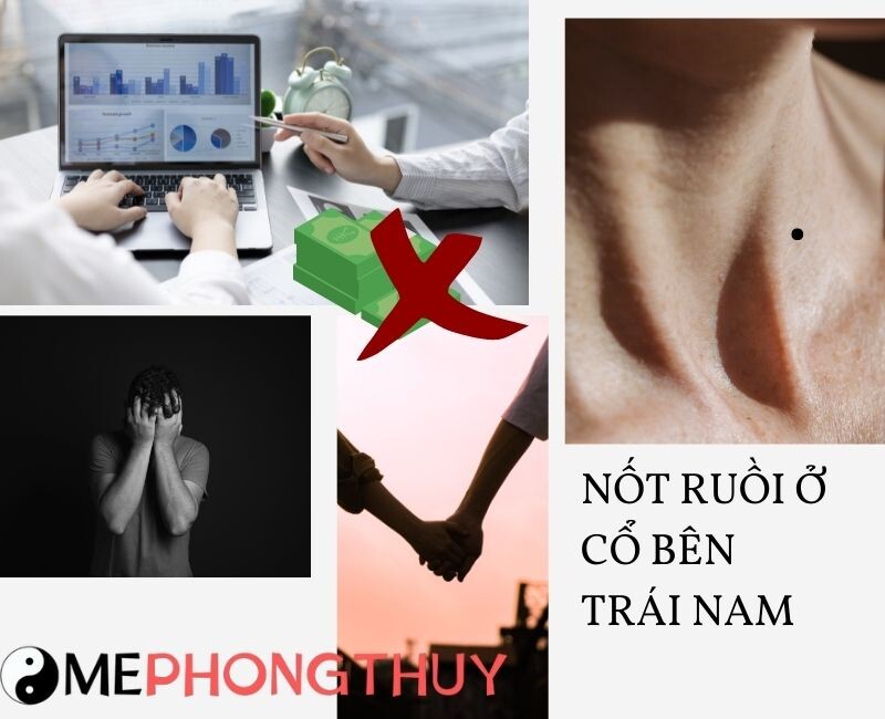 Nốt ruồi ở cổ bên trái nam