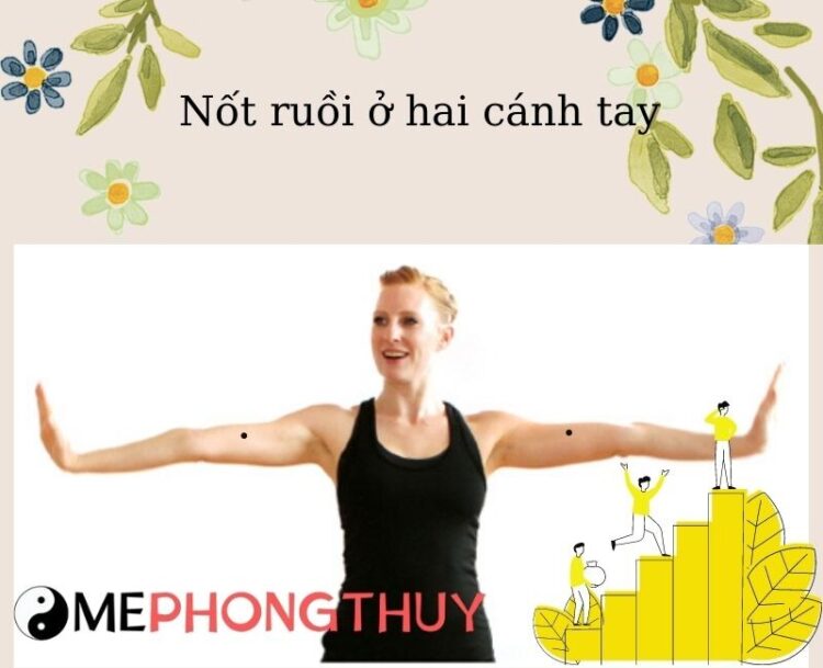 Nốt ruồi ở 2 cánh tay