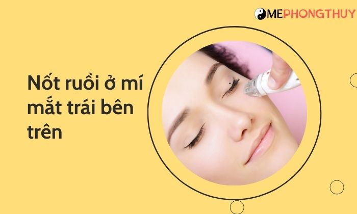 Nốt ruồi ở mí mắt trái bên trên