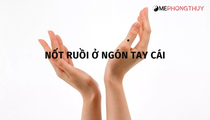 Nốt ruồi ở ngón tay cái