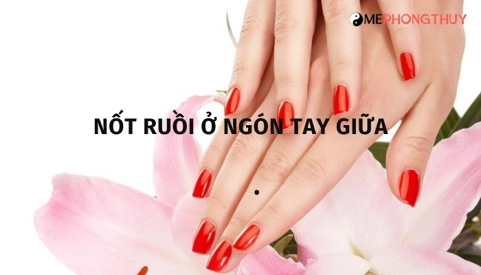 Nốt ruồi ở ngón tay giữa