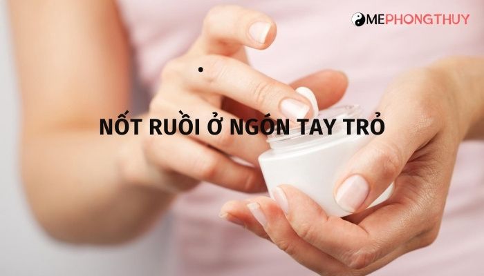 Nốt ruồi ở ngón tay trỏ