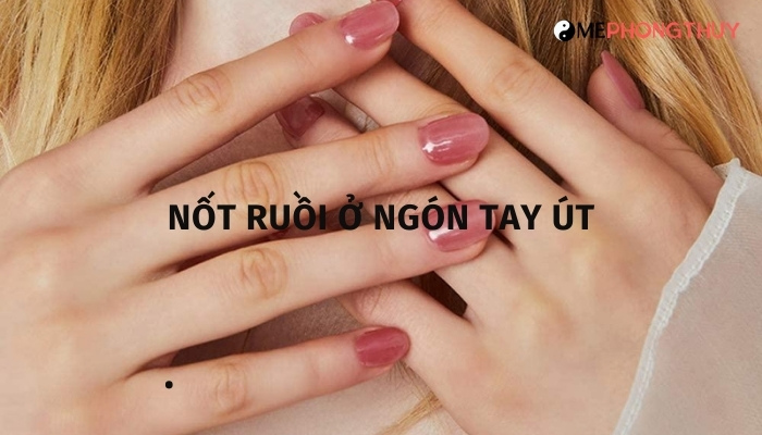 Nốt ruồi ở ngón tay út