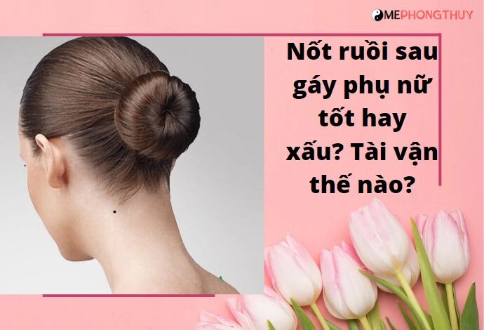 Nốt ruồi sau gáy phụ nữ tốt hay xấu? Tài vận thế nào?