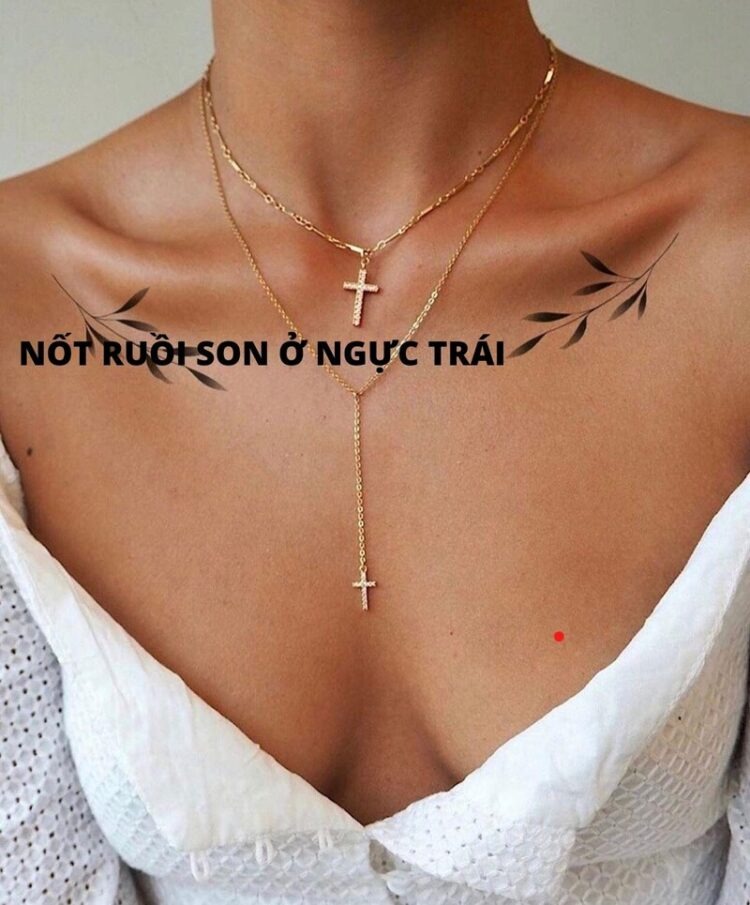 Nốt ruồi son ở ngực trái