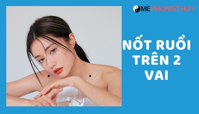 Nốt ruồi trên 2 vai