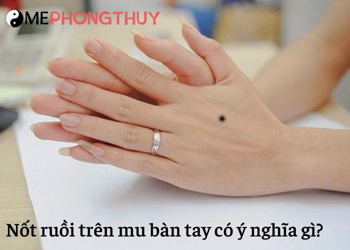 Nốt ruồi trên mu bàn tay có ý nghĩa gì