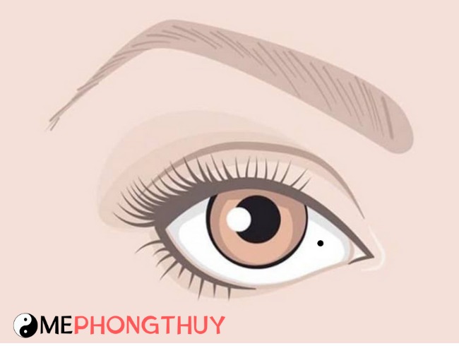 Nốt ruồi trong mắt có ý nghĩa gì