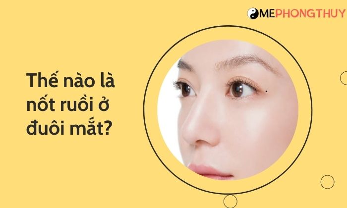 Thế nào là nốt ruồi ở đuôi mắt