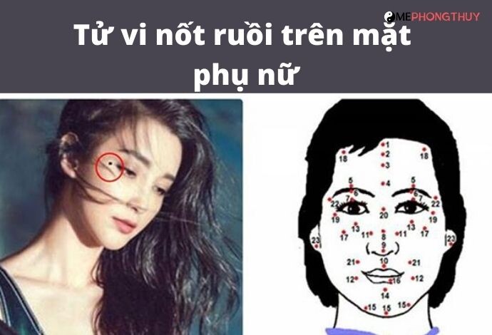 Tử vi nốt ruồi trên mặt phụ nữ