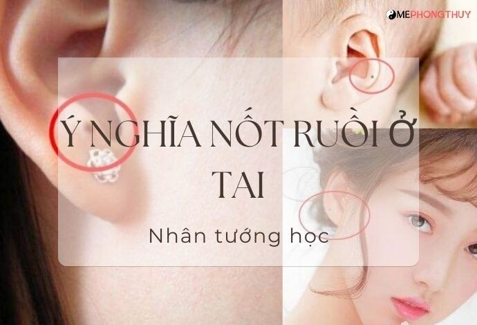 Ý nghĩa nốt ruồi ở tai