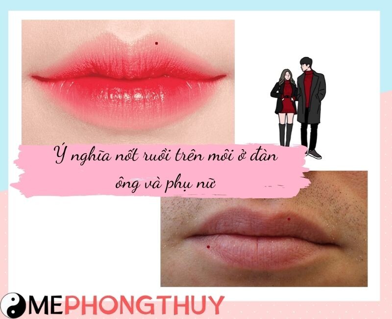 Ý nghĩa nốt ruồi trên môi ở đàn ông và phụ nữ