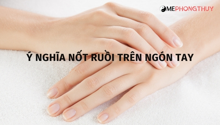 Nốt ruồi trên ngón tay nói lên điều gì